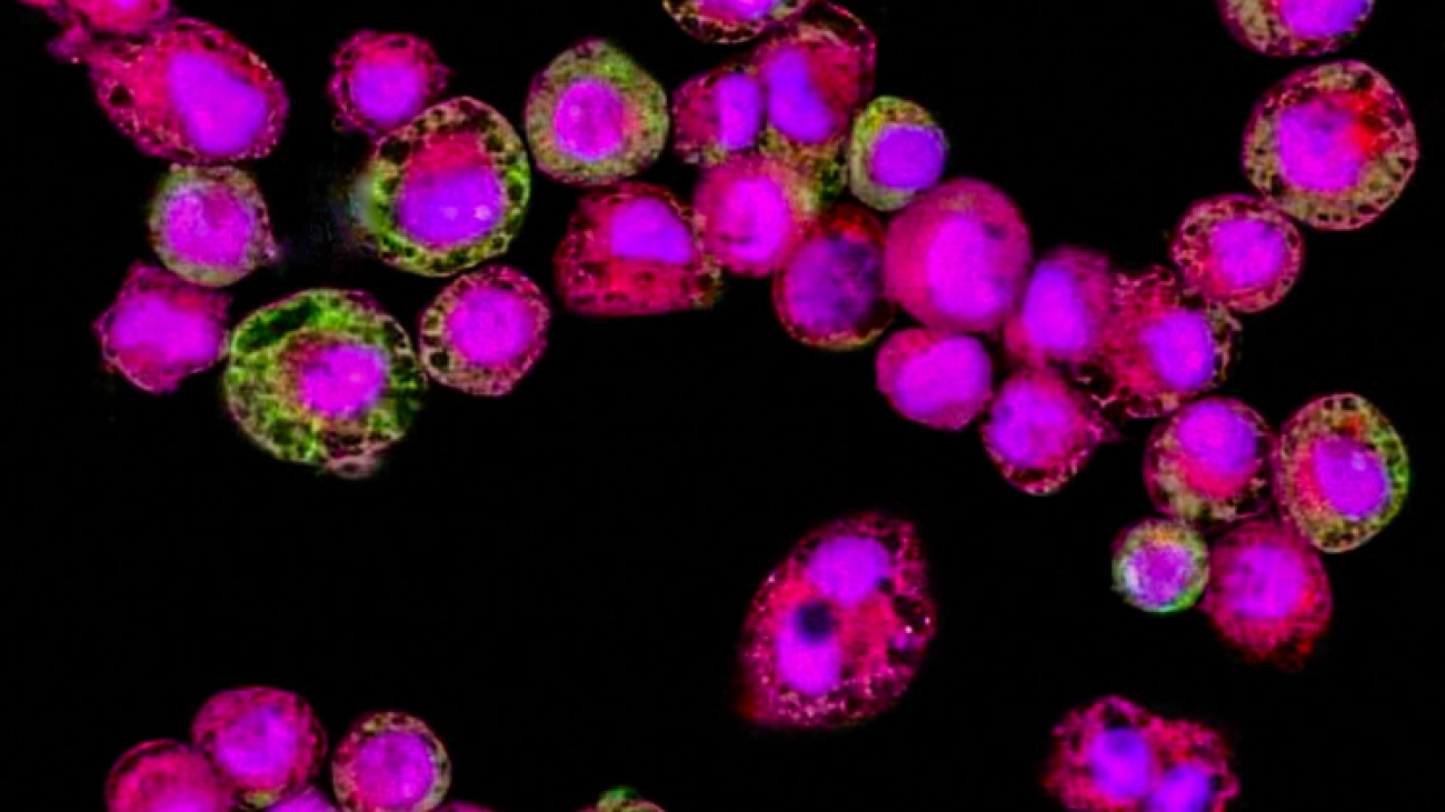 Macrophage toxicology as shown via high content imaging
