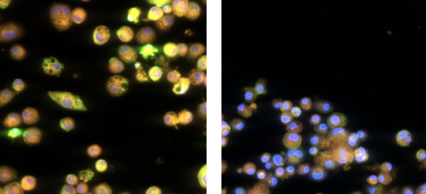 An in vitro endpoint that provides direct read across from in vivo histopathological features of T‐DXd‐induced lung toxicity